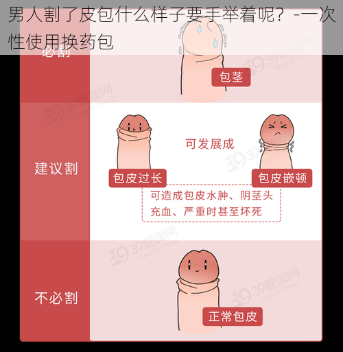 男人割了皮包什么样子要手举着呢？-一次性使用换药包